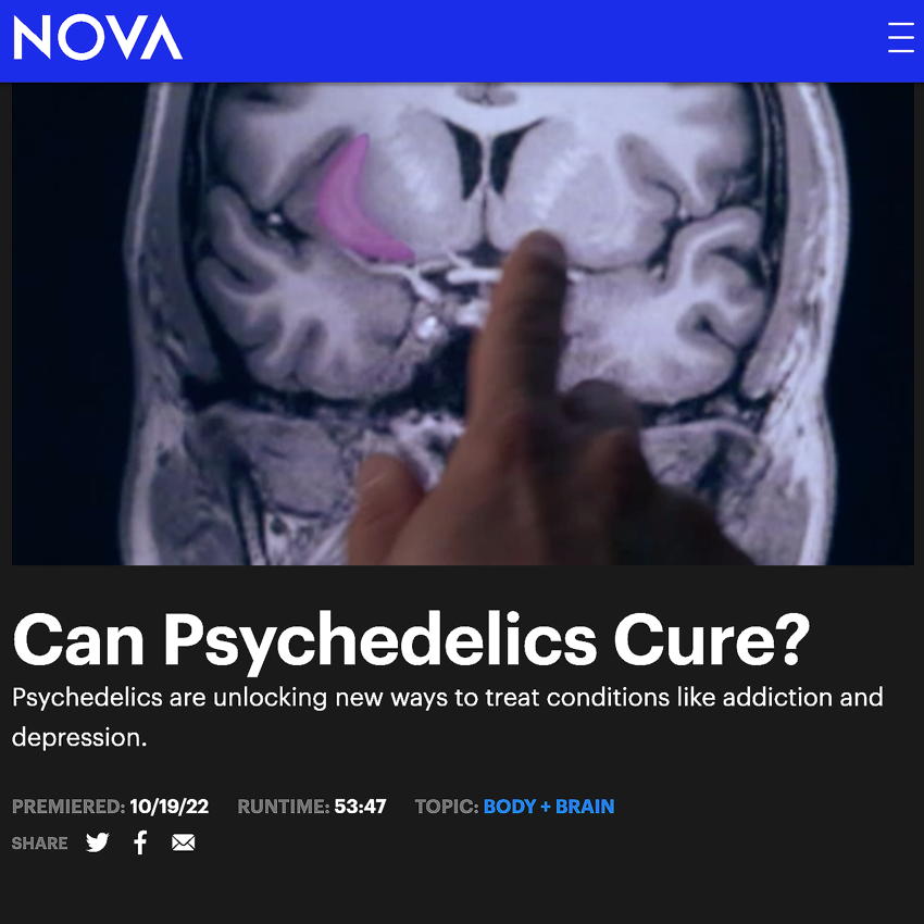 Brain scan with psychedelics